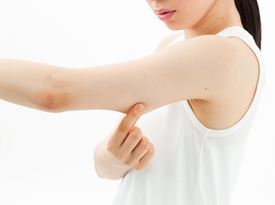 医師が教える二の腕の脂肪吸引で後悔しないために知るべき知識
