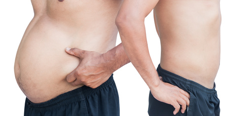 脂肪吸引を考えている男性が事前に知っておきたい4つの知識